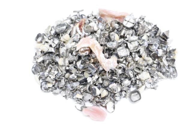 撤去冠(金銀パラジウム冠)